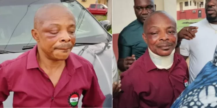 NLC President Ajaero To Be Flown Abroad For Medical Care