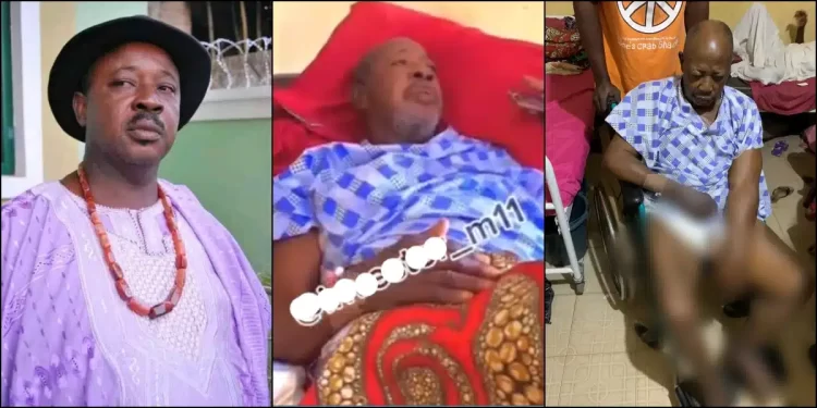 Mr Ibu's Colleague Amaechi Muonagor Hospitalized As He Suffers Paralysis After Stroke